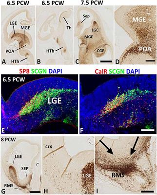 Multiple Origins of Secretagogin Expressing Cortical GABAergic Neuron Precursors in the Early Human Fetal Telencephalon